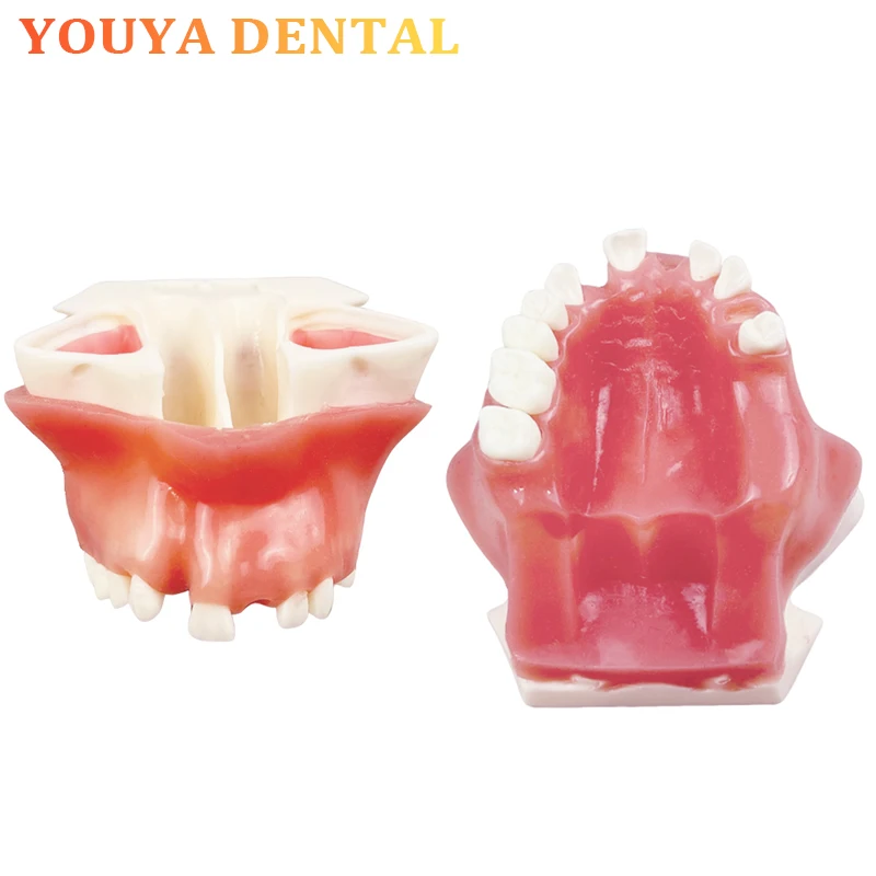 

Maxillary Sinus Missing Teeth Implantation Practice Model Maxillary Tooth Model Dental Implant Practice Teaching Model