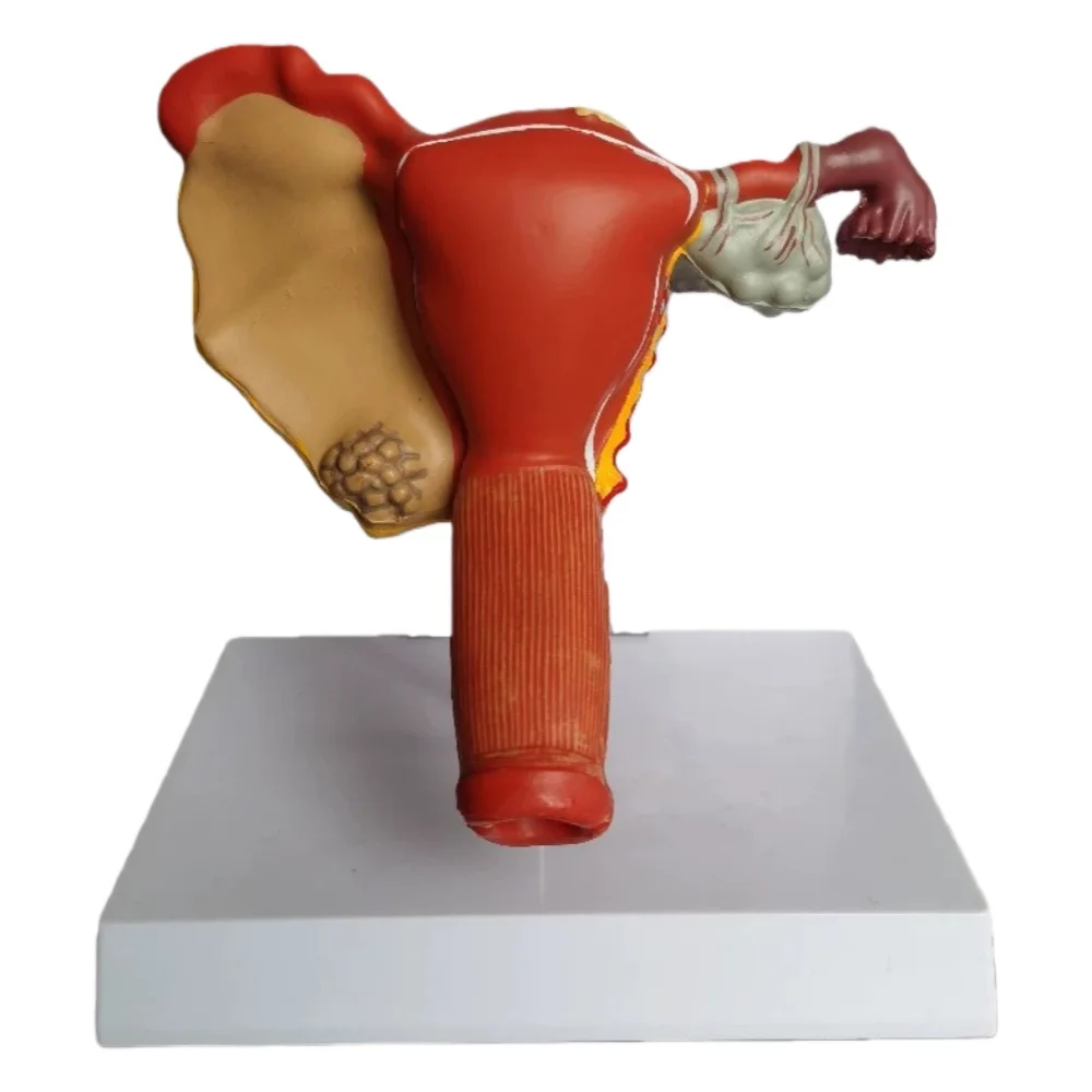 

Medical Science Female Human Uterus Model Pathological Model