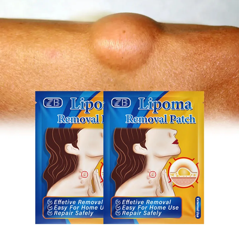 6Pcs Lipoma Remove Patch Herb Anti-Tumor Fat Mass Swelling Pain Stickers Body Hard Block Relief Health Care Medicine Plaster