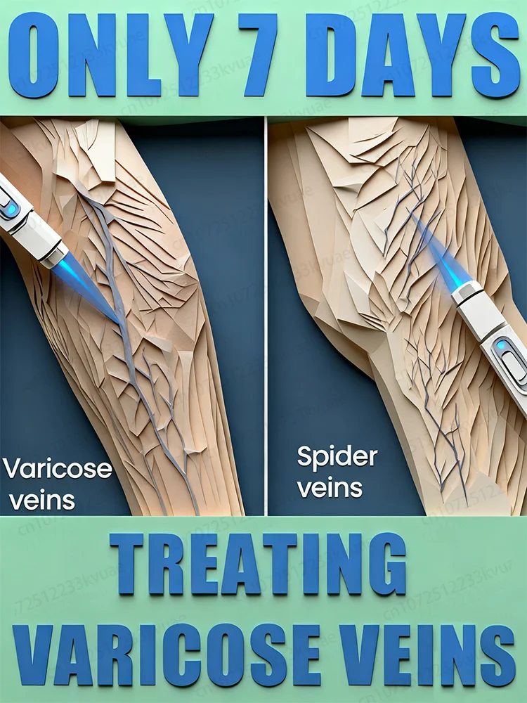 Laser-Ader-Stift. Entfernen Sie Krampfadern aus dem Körper