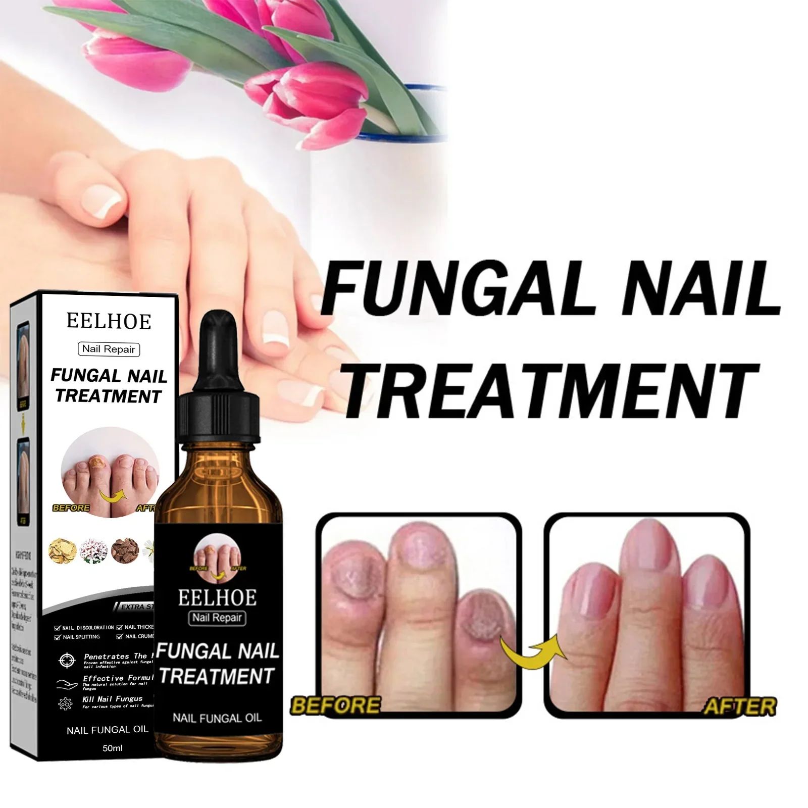 Toenail Care Nail Repair Solution Natural Nail Essence Fix Renew Damaged Molds Broken Cracked Discolored Nails Fast Repair Serum