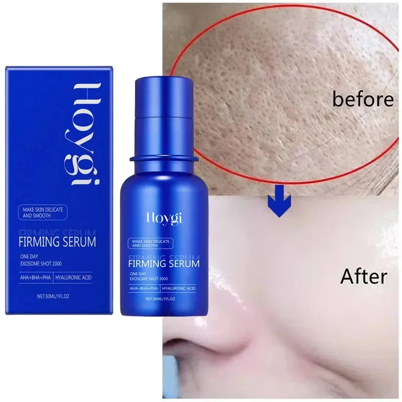 Blue Microneedle Shrink Pores Facial Essence Soft Moist Face Beauty Collagen Jelly Cream Firming Smooth Brighten Korean Cosmetic