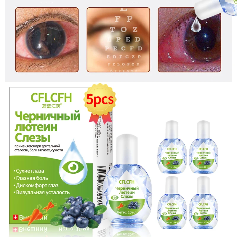 

Eyesight Improvement Blueberry Lutein Eye Drops Eyes Pain Dry Itchy Visual Fatigue Myopia Protect Vision Care Russian Language