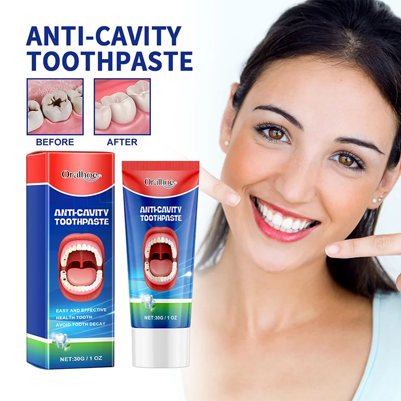 Dentifrice anti-carie dentaire, crème réparatrice de caries, prévention de la carie dentaire, remodelage du calcul dentaire, protège les dents, rafraîchit l'haleine, 30g