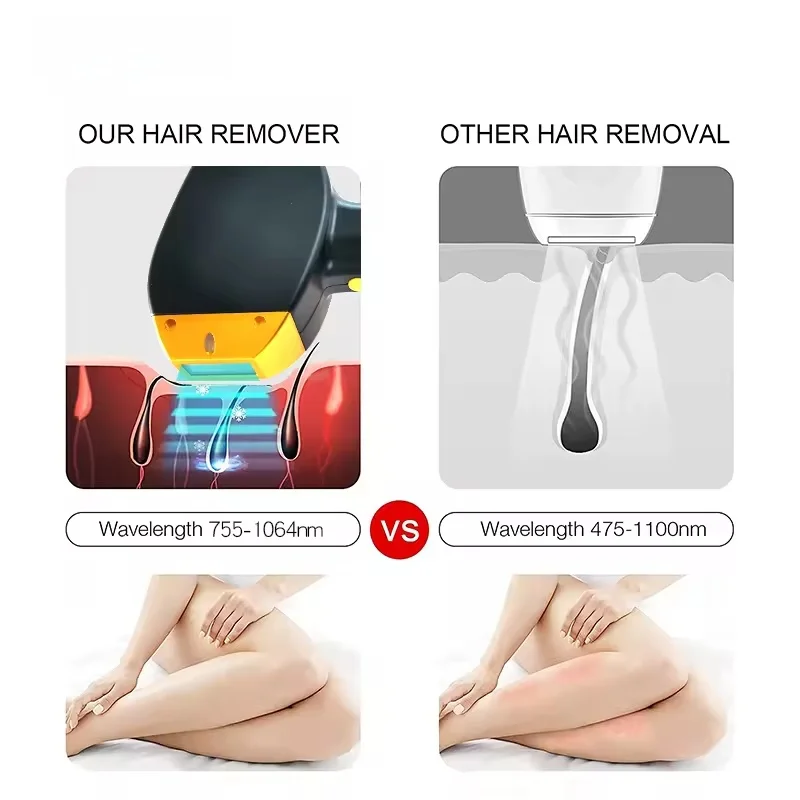 

Professional 4500W Soprano Titanium Diode Laser Hair Removal Machine High Power Alexandrite Laser 808nm 755nm 1064nm