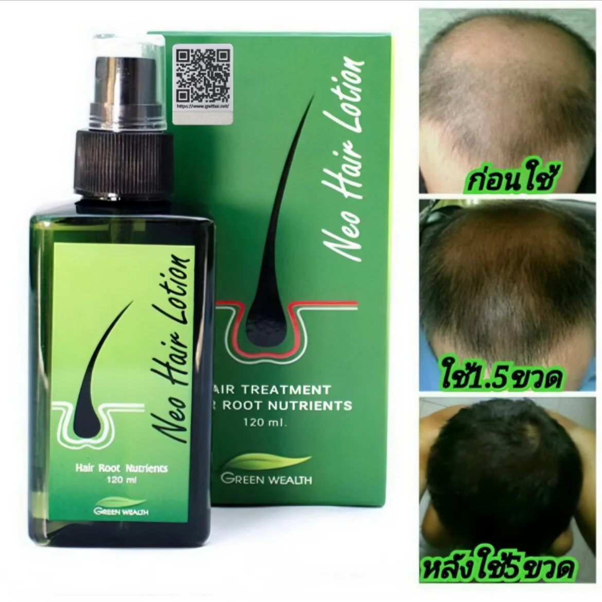 120ml Neo Hair Lotion Hair Root HAIR BEARD SIDEBURNS LONGER Herbs Treatment 100% Original Thailand Free Gift