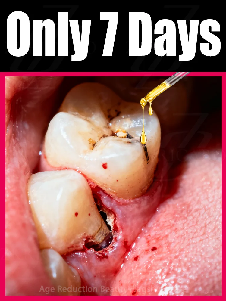 

Eᴀsɪʟʏ ʀᴇɢᴇɴᴇʀᴀᴛᴇ ɢᴜᴍs ᴀɴᴅ ᴄᴏᴠᴇʀ ᴛᴇᴇᴛʜ ɪɴ 7 ᴅᴀʏs