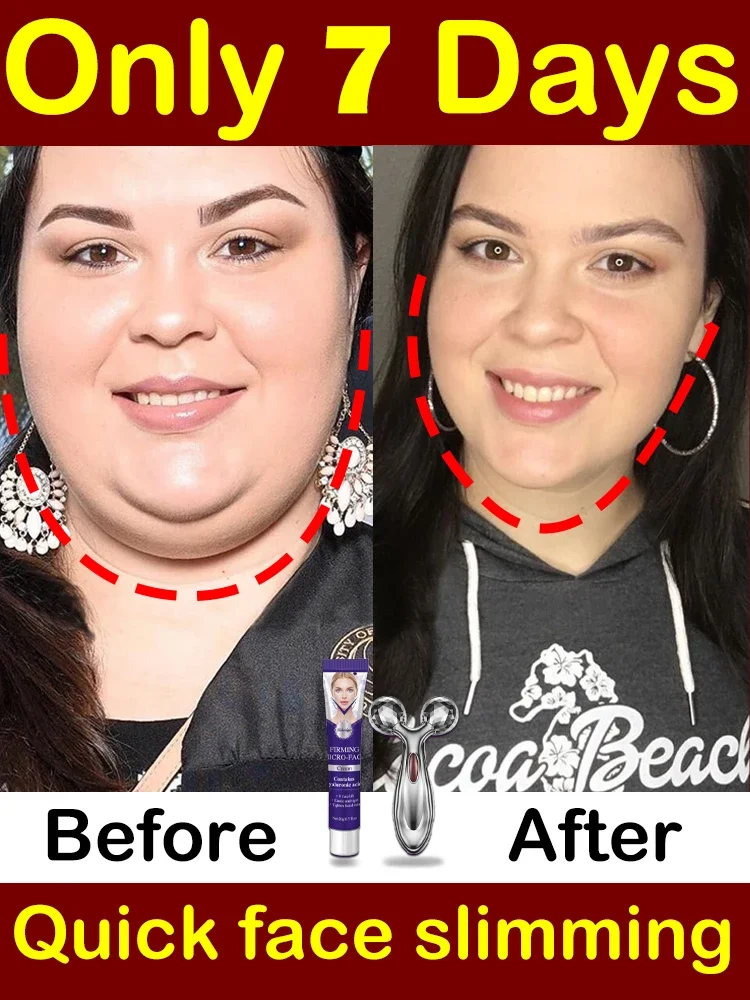 

Double chin removal