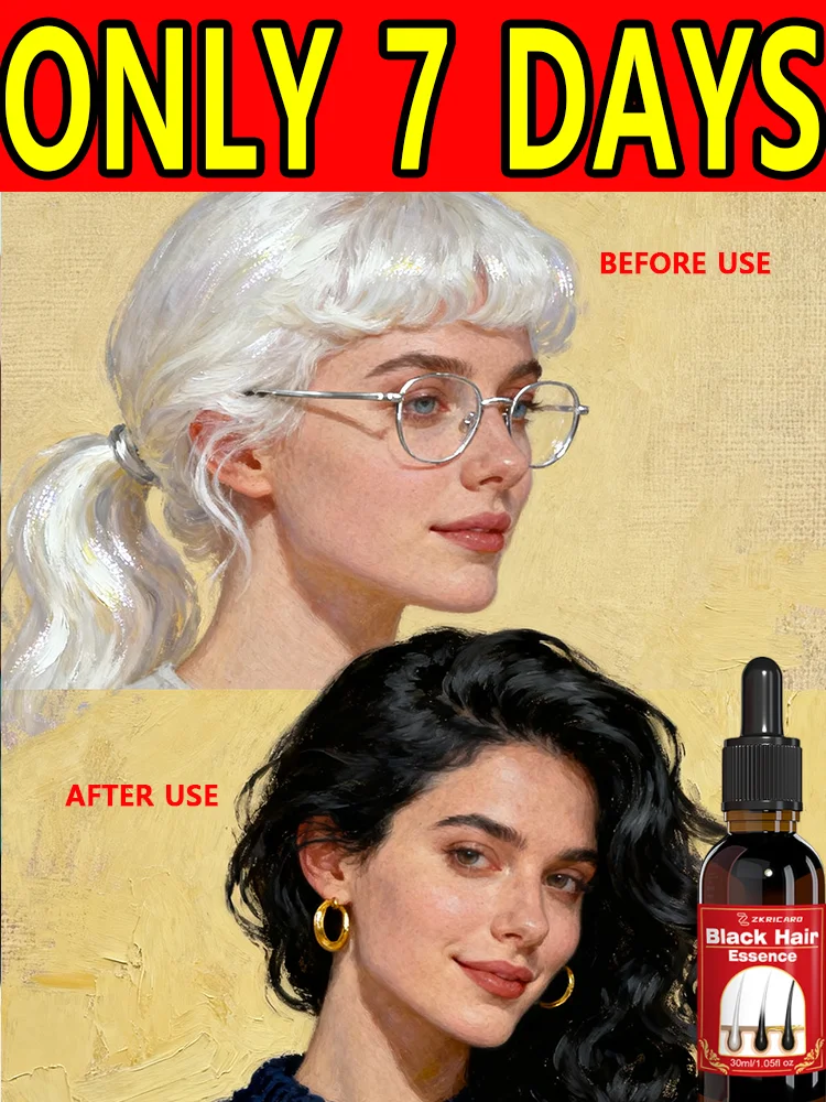 

Natural Ginger Extract Hair Serum - Reverses gray hair, strengthens hair, and prevents graying; suitable for both men and women