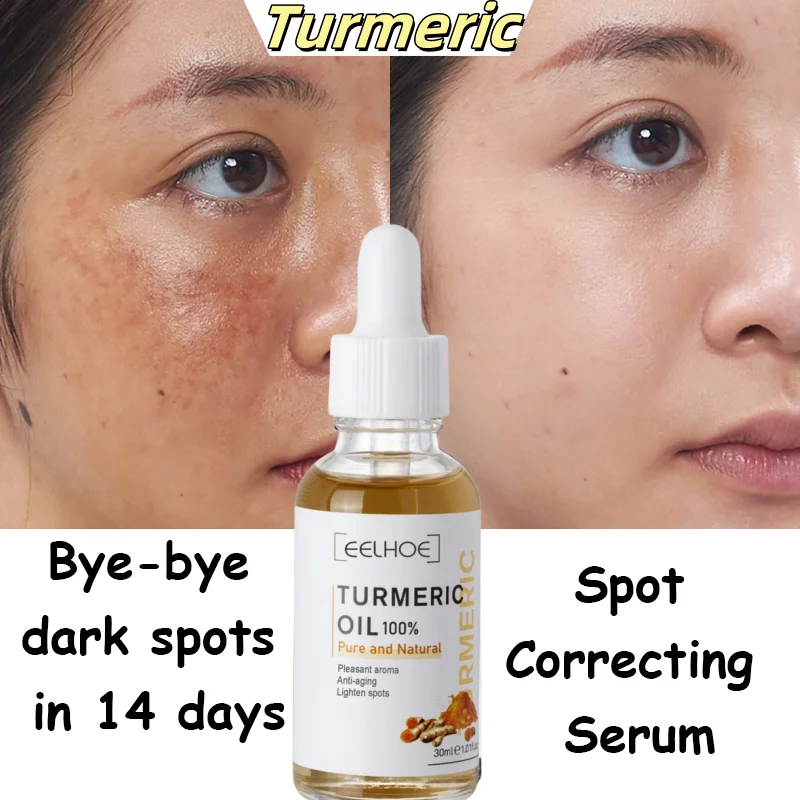 

Freckle Remove Turmeric Serum Curcumin Oil Face Whitening Brighten Moisturizing Fade Dark Spot Removal Melaninskin Turmeric Oil