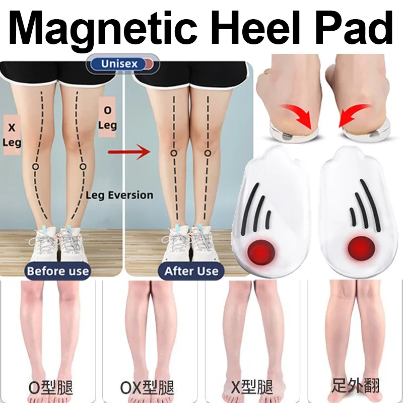 1/5Pair O/X Leg Type Valgus Correction Men Women Silicone Gel Shoes Insole Orthopedic Insoles for Feet Magnet Massage Shoe Pads