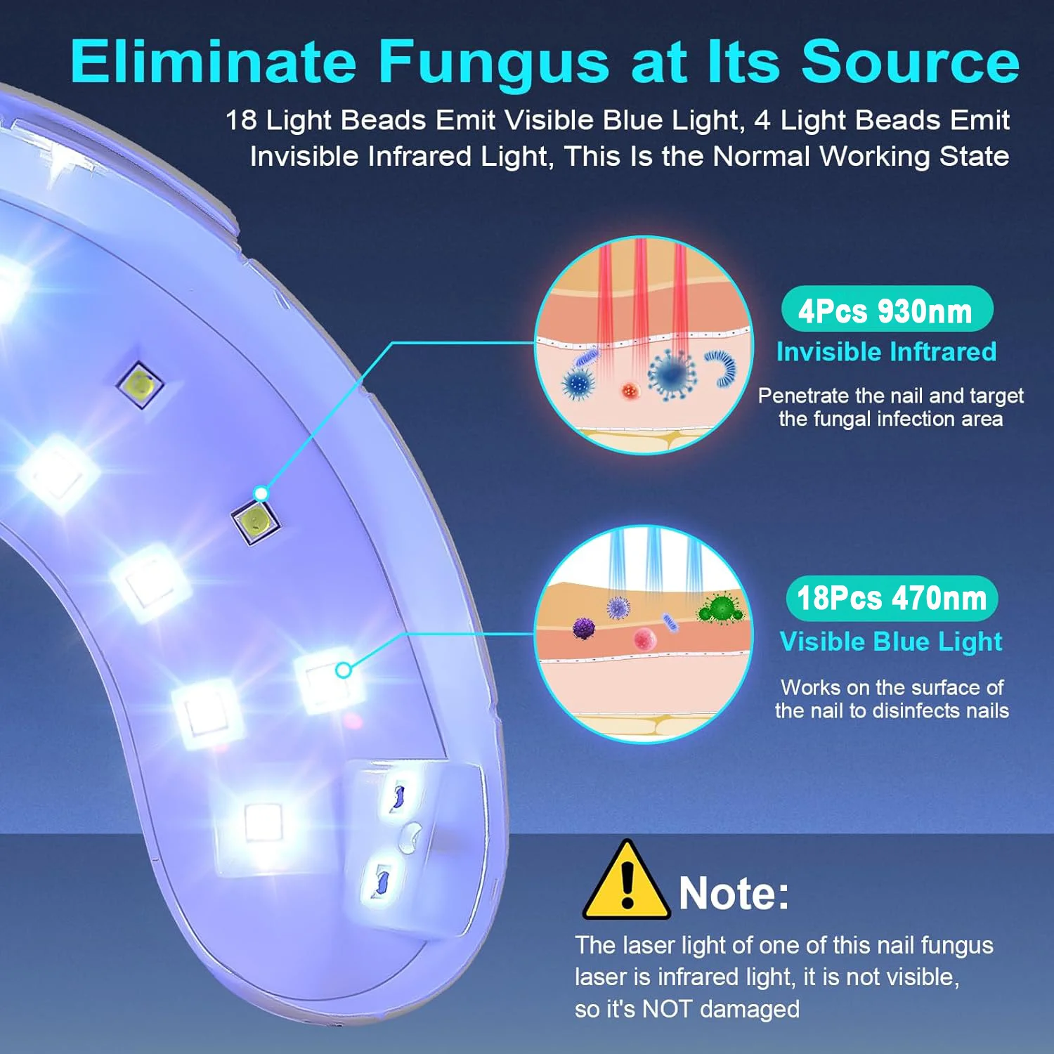 진균성 손발톱 레이저 기기 - 속효성 손발톱 진균증 및 내성발톱 치료, 발톱 및 손톱 곰팡이 제거로 발 관리