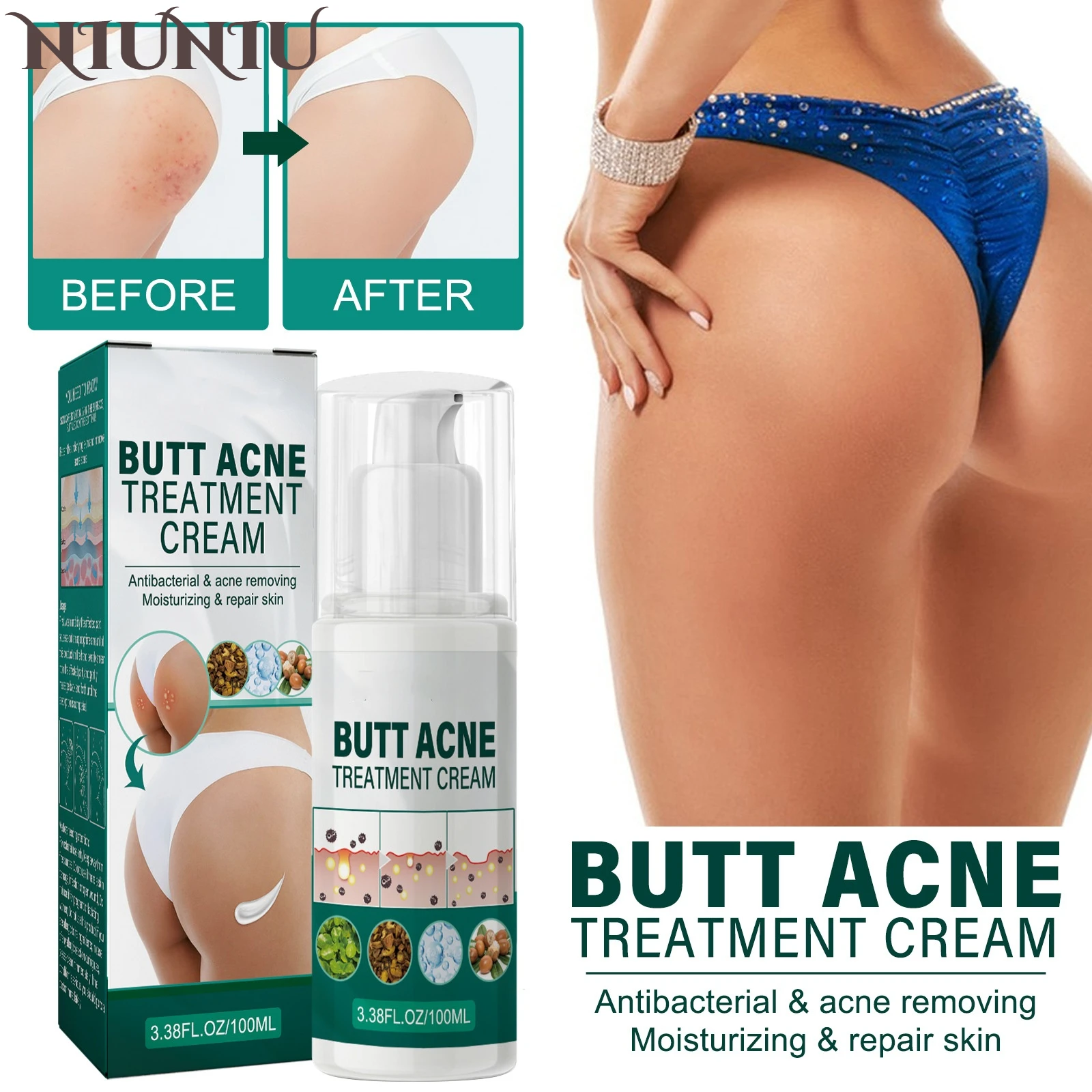 

Buttocks Care Cream Moisturizes Lightens Melanin Rejuvenates Skin Repairs Lotion Improve Rough Skin Brightening Serum Deep Care