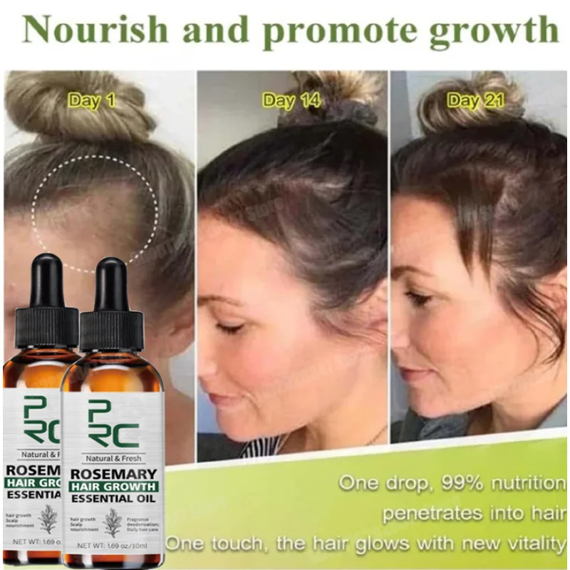 

Rosemary Oil Hair Growth for Men Women Fast Growing Products Essential Oils Ginger Anti Hair Loss Scalp Treatment Hair Care