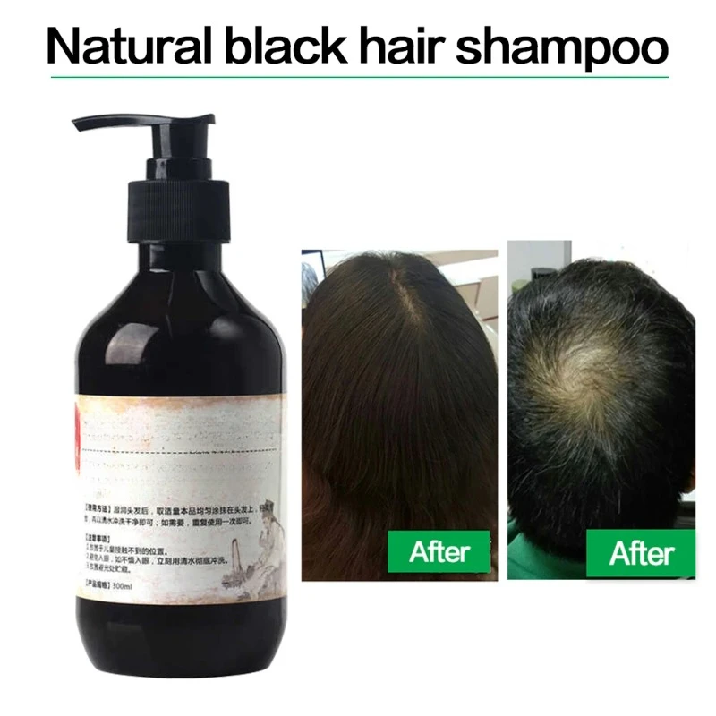 

300ml Herbal Natural Shampoo Plant Liquid Grey Hair White Hair Removal Turn Permanent Black Hair Care