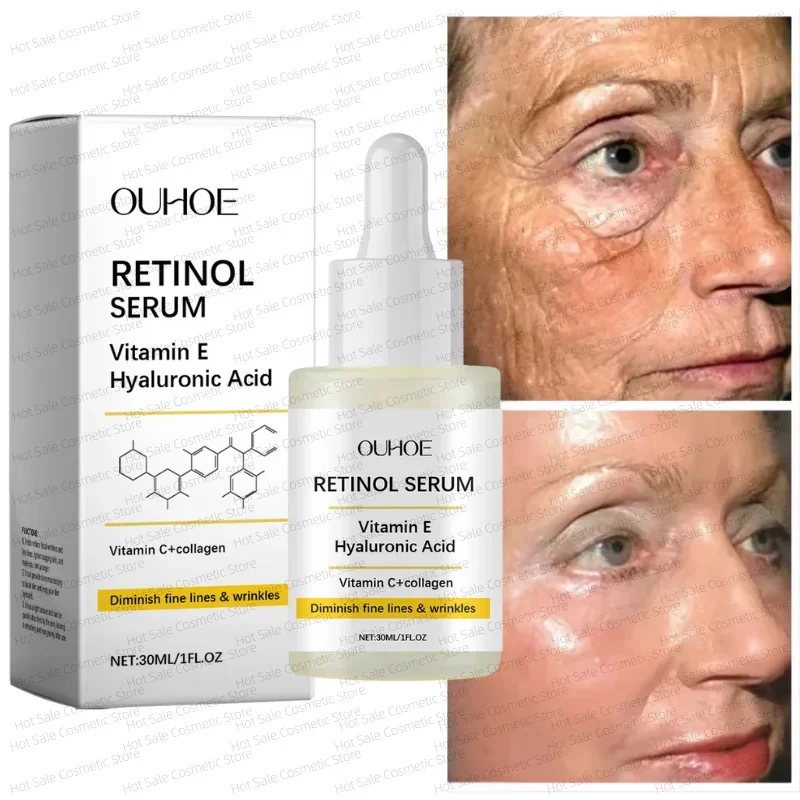 

Retinol Face Serum Deep Moisturizing Younger Fade Fine Line Lifting Firming Repair Smooth Tighten Serum Hyaluronic Acid Serum