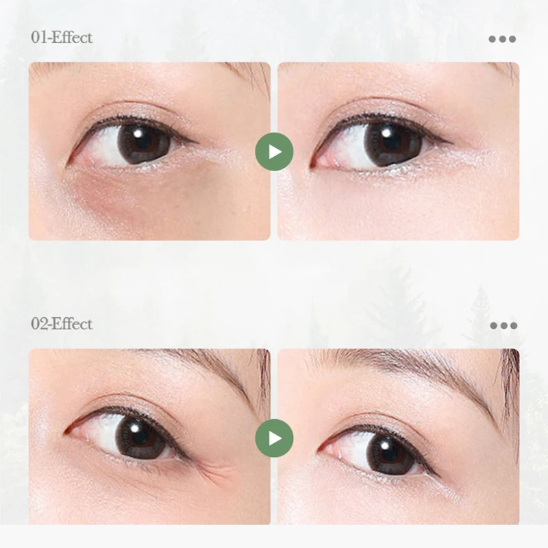 Remove Wrinkles Eye Cream Anti Dark Circles Under Eyes Puffiness Moisturizing Bags Puffiness Fade Eye Fine Tighten Under Eyes