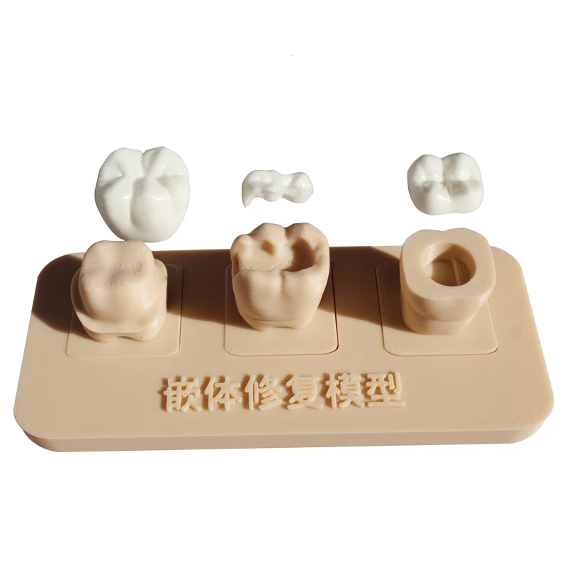 Embedded restoration model, oral teaching model, removable dental prosthesis model, doctor-patient communication model