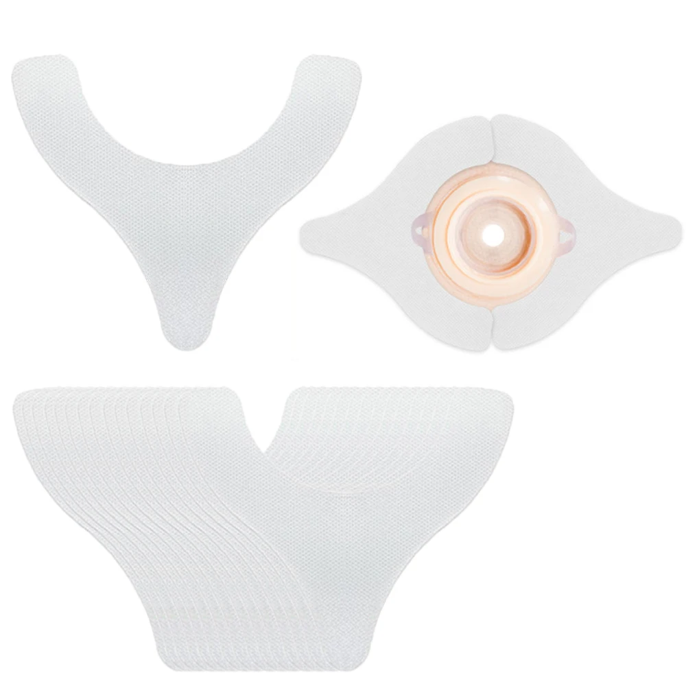 

20 шт., удлинительная лента для уплотнения стомы, колостомический мешок, клейкая лента Y-образной формы, йлеостомия, стома, барьерная лента, водонепроницаемая лента для утечки