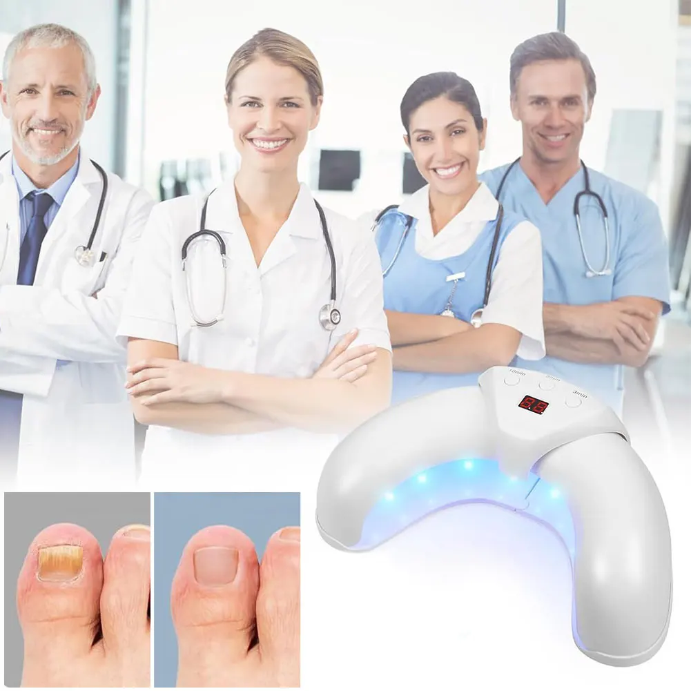 Soluzione per la riparazione delle unghie Dispositivo per la pulizia delle unghie per uso domestico Dispositivo per il trattamento delle unghie a luce blu da 470 nm per unghie dei piedi e delle mani