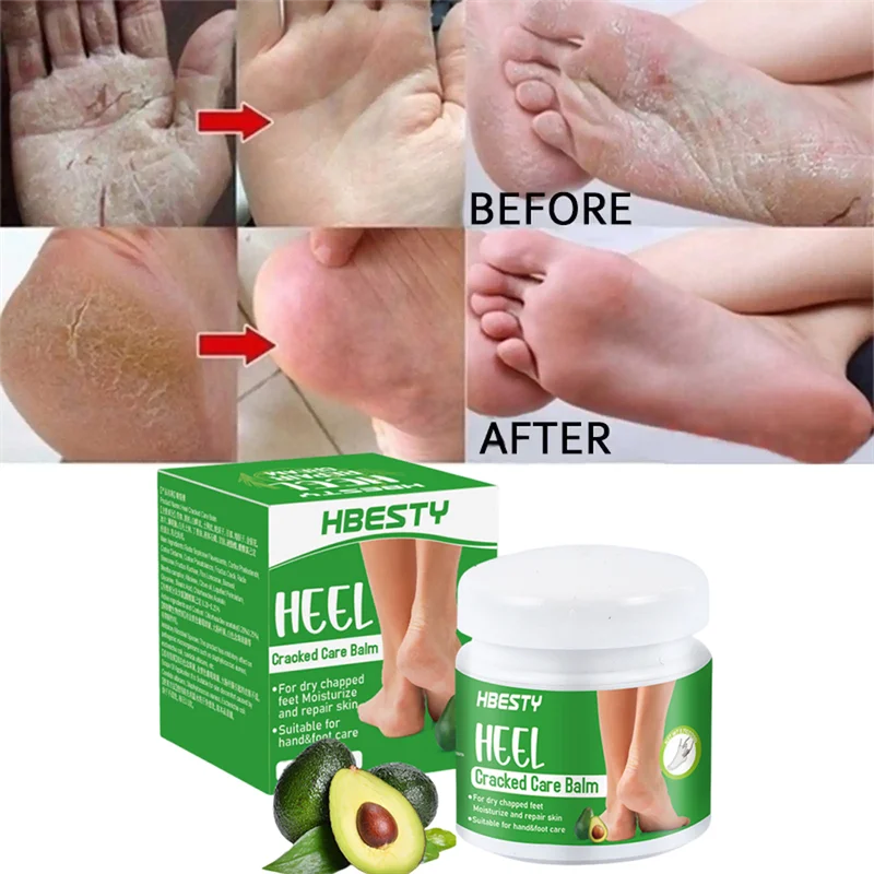 Herbal Anti Cracked Heel Treatment Cream Anti-Drying Removal Callus Dead Skin Balm Hand Foot Mositurizing Repair Skin Care Mask