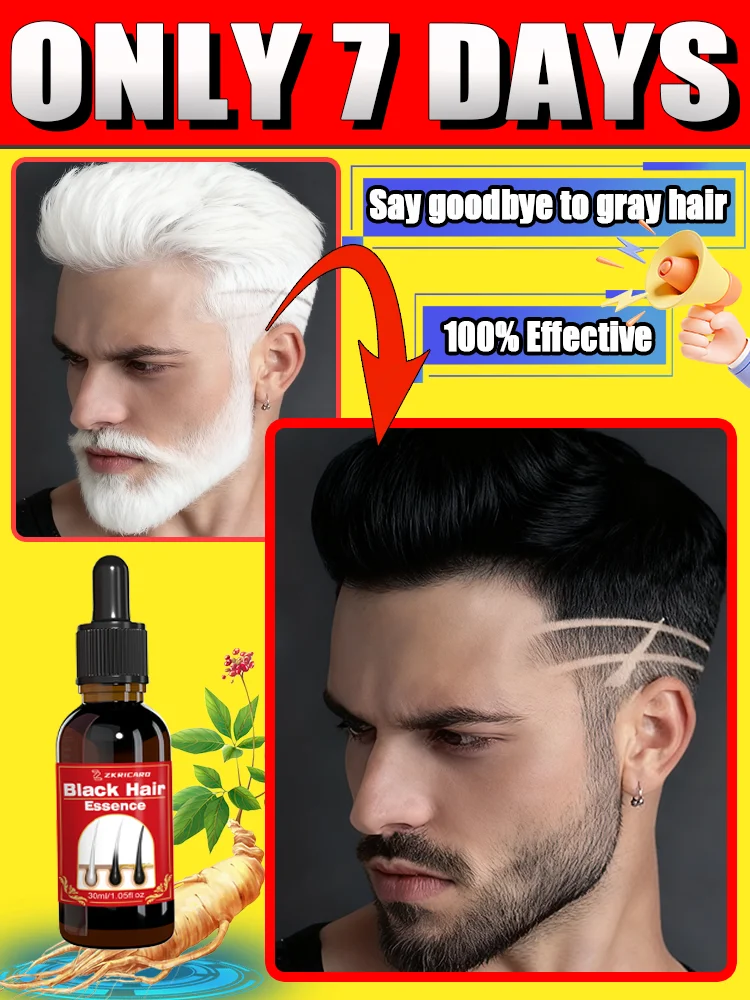 

Nᴀᴛᴜʀᴀʟ ᴡʜɪᴛᴇ ʜᴀɪʀ ᴛᴏ ʙʟᴀᴄᴋ ʜᴀɪʀ ᴇssᴇɴᴄᴇ, ɢɪɴsᴇɴɢ ᴇxᴛʀᴀᴄᴛ, ᴘʀᴇᴠᴇɴᴛs ɢʀᴀʏɪ