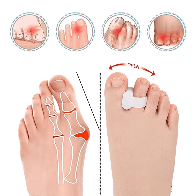 1/2/5/10Pairs Hammertoe Corrector Toe Splints Realign Bent Curled Claw Hammer Toes Toe Separator Straighteners for Men and Women