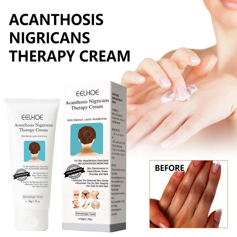 Body Whitening Cream Arms Armpits Thigh Underarm Knee Elbow Repair Whiten Brighten Moisturizing Dark Remove Skin Care Products