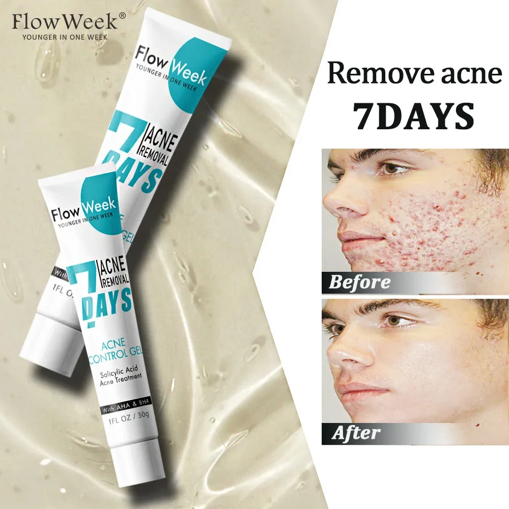 FlowWeek Salicylic Acne Face Gel Pimple for Teens Blackhead Removal Shrink Pore Oil Control Moisturizing Facial Cream Skin Care