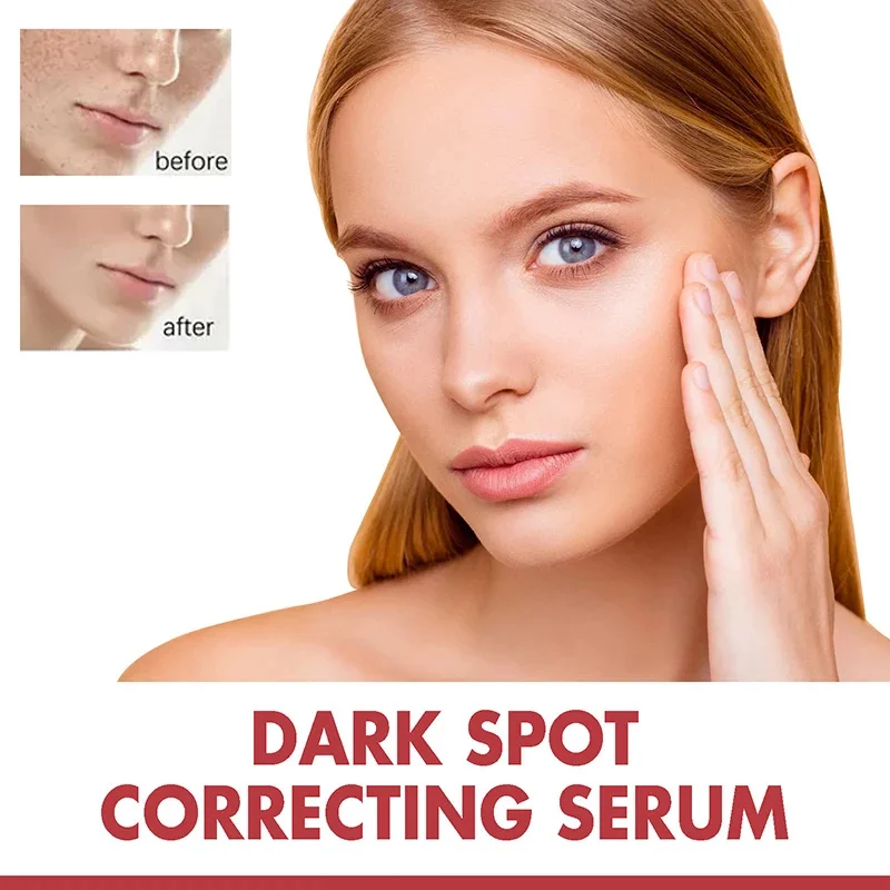 Niacinamide Serum Dark Spot Correcting Moisturizing Brightening Fade Fine Lines Deep Cleaning Makeup Remover Korean Skin Care