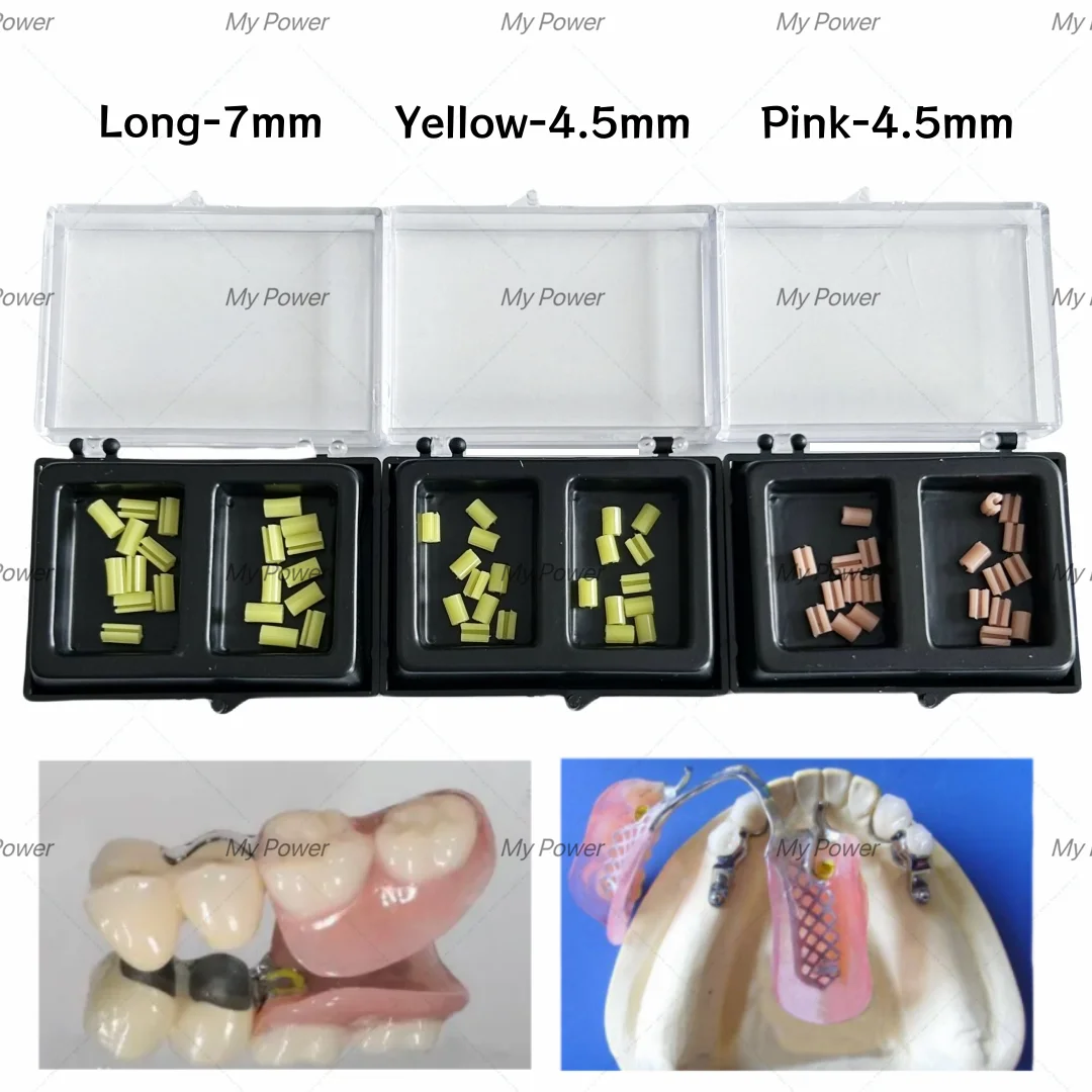 Dental Clips Bolt Inserts Precision Implant Overdenture Attachment Yellow/Pink Long/Short