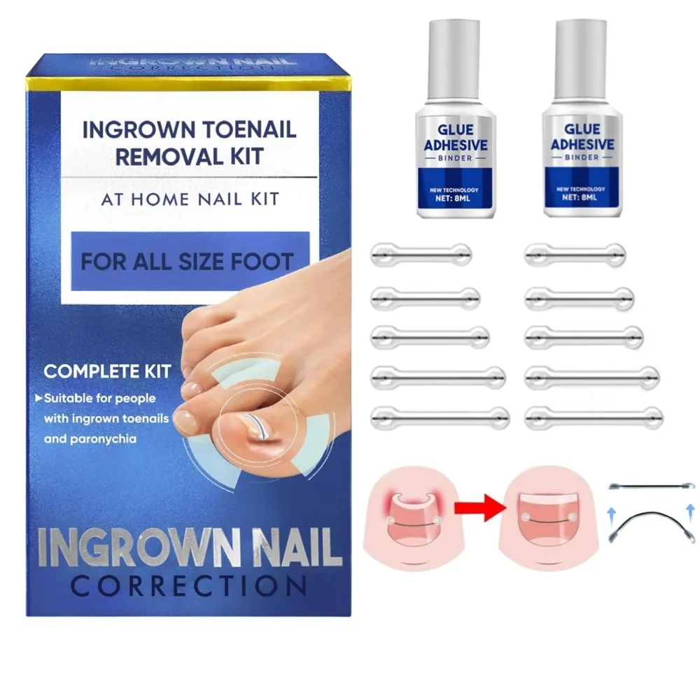 

Ingrown Toenail Treatment, Reusable Ingrown Toenail Removal Kit for All Size Foot, Ingrown Toenail Corrector for Curved Nail at