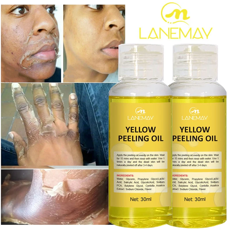 Óleo de peeling amarelo para pele escura, clarear loção, clarear corpo, cotovelo, joelho, mão, esfoliar, pele morta nutrir, mesmo tom de pele, alvejante, forte