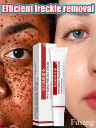 Removedor de manchas escuras do rosto para mulheres, creme de remoção de melasma e sardas, creme clareador de melanina