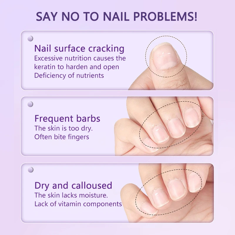 1/2/PCS 3-in-1 Penna per olio per cuticole Rimozione della pelle morta Spingipelle Penna per molatura con punta in ceramica Penna per rimozione cuticole Strumento per la cura delle unghie