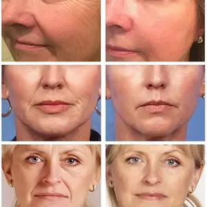 10 Hauptverkäufe Rugol Cream - №8