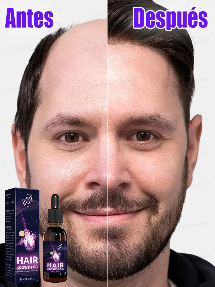 毛包を刺激し、頭皮に栄養を与え、7日間で髪を素早く再生します