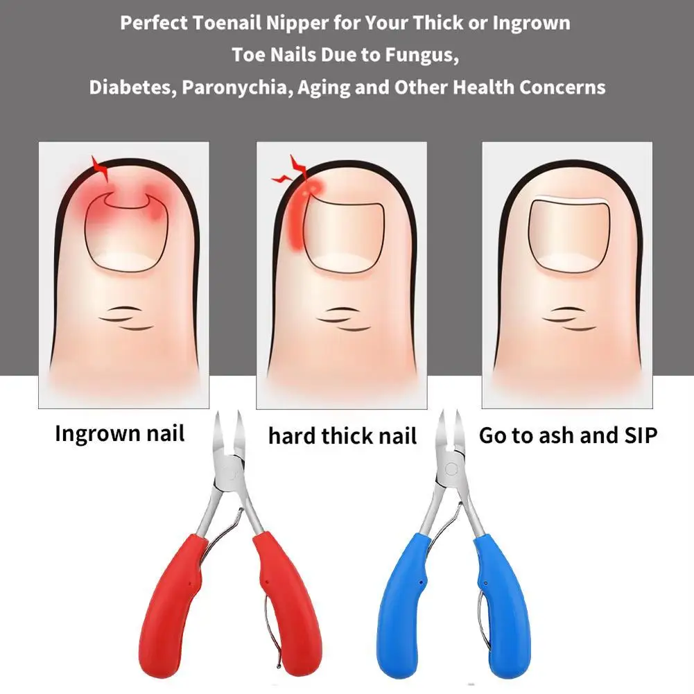Cortauñas para dedos de los pies, corrección de uñas gruesas, piel de uñas encarnadas, pinzas para el cuidado de las uñas de los pies, alicates cortadores, pedicura, arte muerto, Manicur F2O8