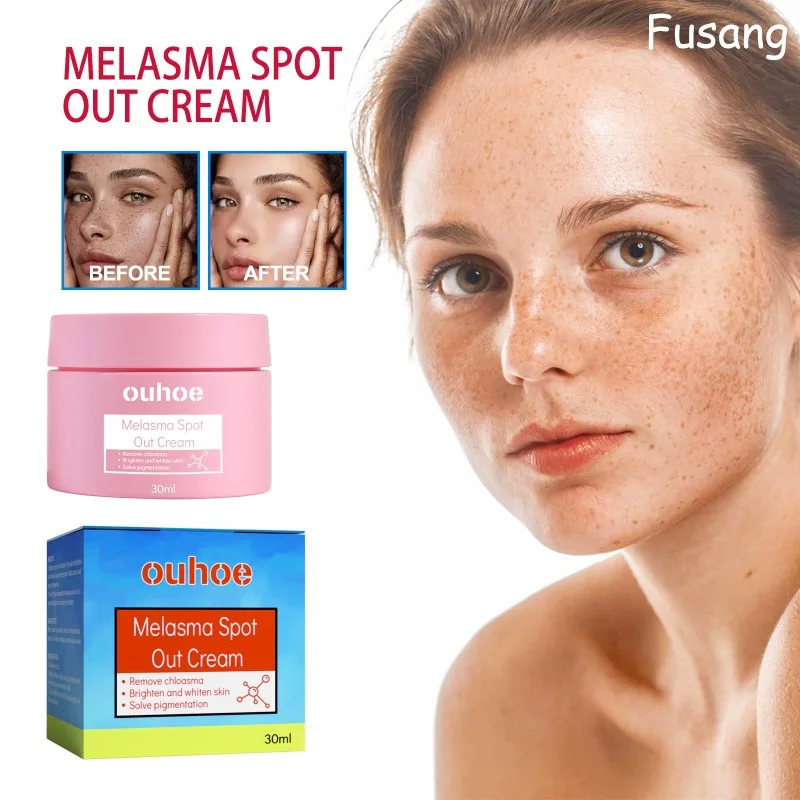 Effective Remove Melasma Cream Niacinamide Brightening Facial Cream Lightens Black Skin Products Fade Pigment Chloasma Remover