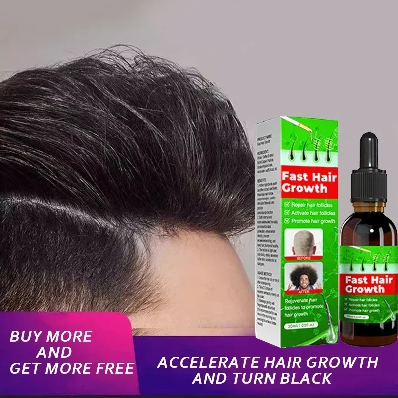 

Fast Hair Growth Promoter Products Hair Loss Hereditary Seborrheic Alopecia Treatment Oil For Hair Growth Essence Natural Safety