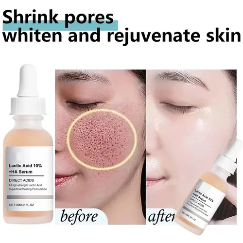 Suero de ácido láctico para reducir los poros, eliminación rápida de poros grandes, esencia reafirmante para la piel, reafirmante, suavizante, reparación nutritiva, cuidado de la piel facial