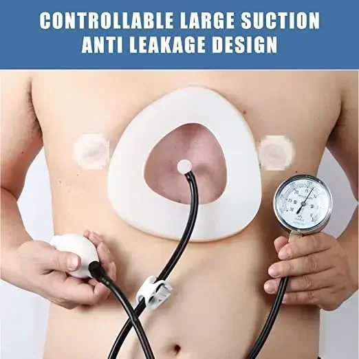 2026/Vacuum Bell Pectus Excavatum Funnel Chest Brace for Children Mend and Women