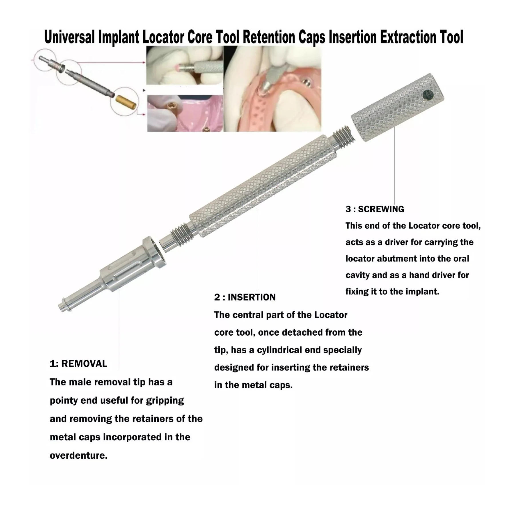 Implant Locat0r Core Tool Retention Caps Insertion Extraction Tool Silver Dental