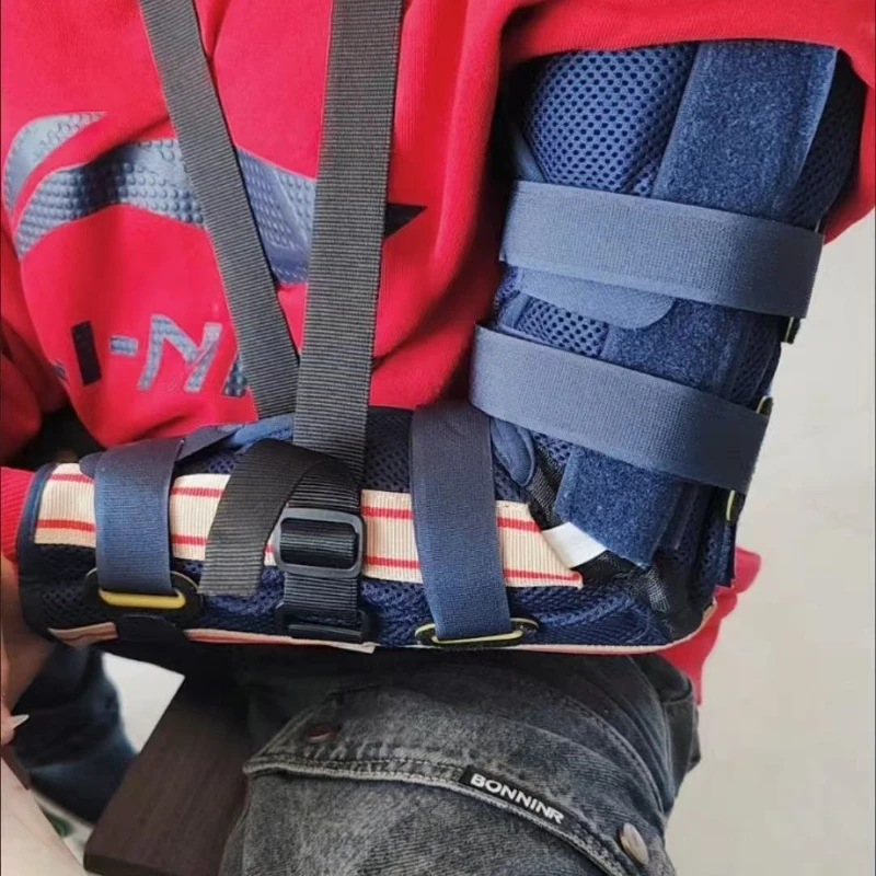 Elbow Restraints for Children Protective Restraints for Arm Fractures and Dislocations Humerus Fractures