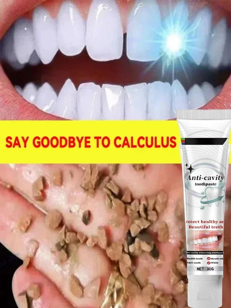 

New Dental Calculus Remover Toothpaste Whitening Teeth Mouth Odour Removal Bad Breath Preventing Periodontitis Dental Cleaning