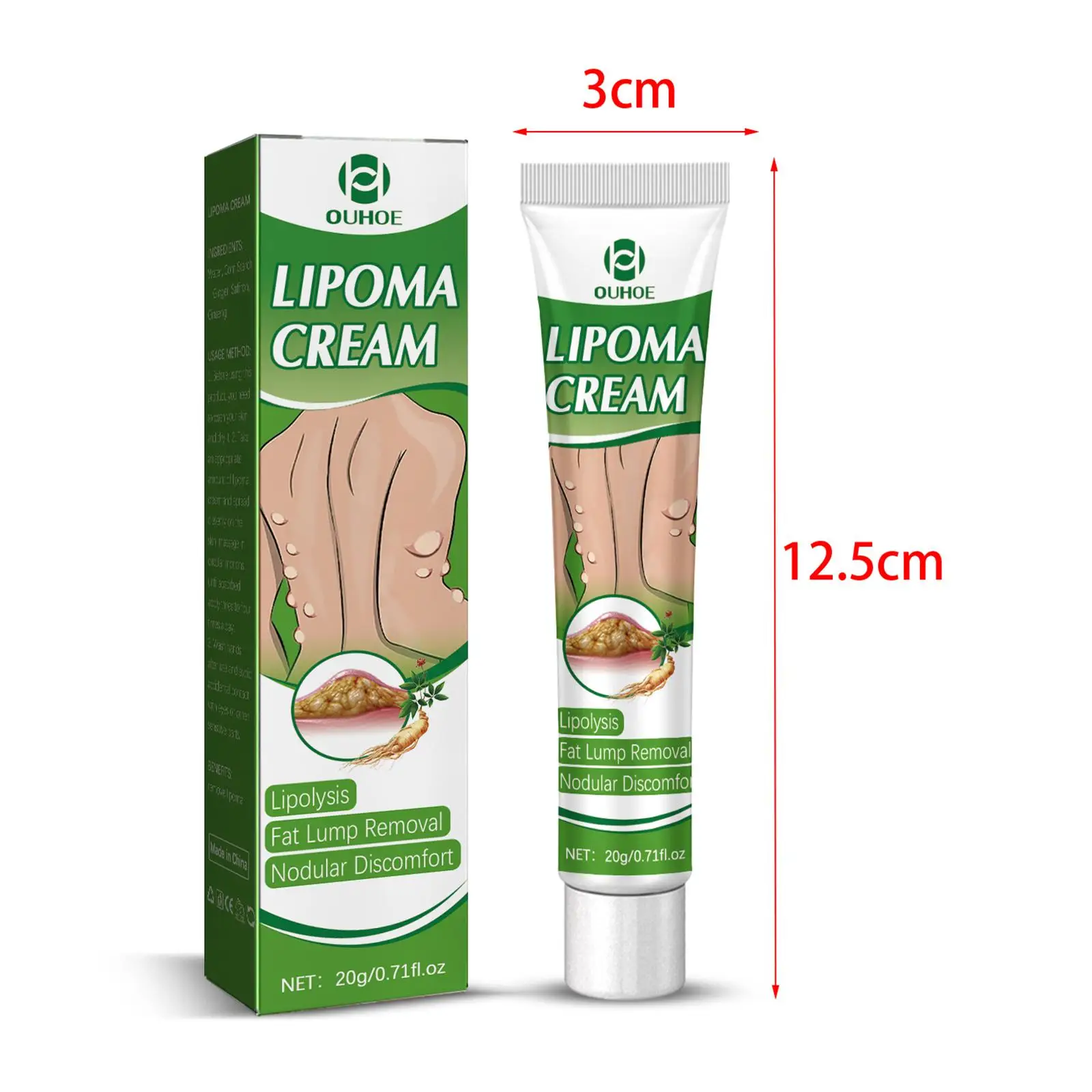 Crema per la rimozione del lipoma da 0,71 fl.oz Crema portatile per la cura della pelle Disagio nodulare Rimozione del lipoma