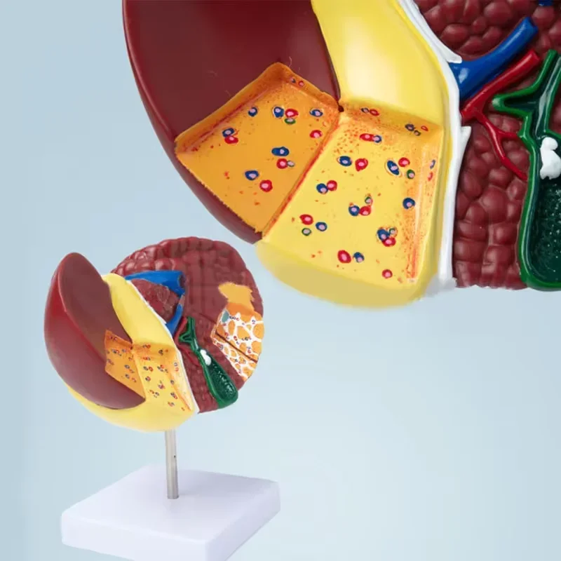 Pathological Liver Anatomical Model 1:1 Human Liver Model Anatomy Display for Medical School Study and Research