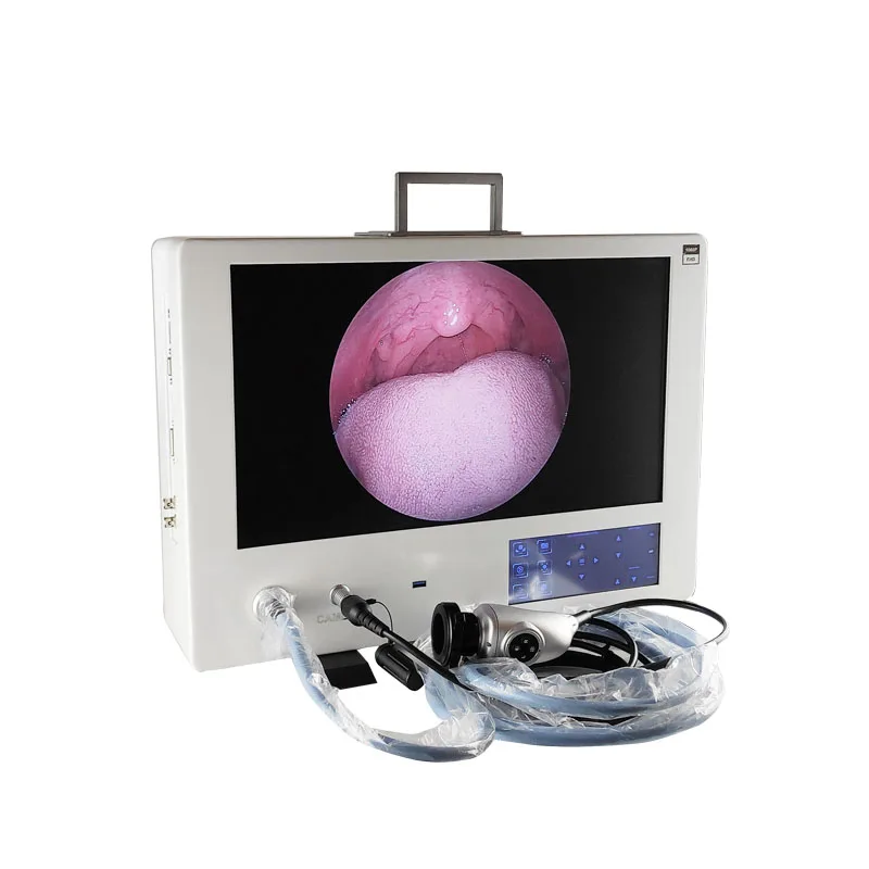 Medical Portable USB 3.0 Record Integrated Endoscopic  Hine With Light Source