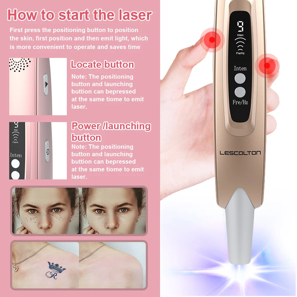 Les colton neue Laser Piko sekunden Stift Sommersprossen Tattoo Entfernung Maulwurf Fleck
