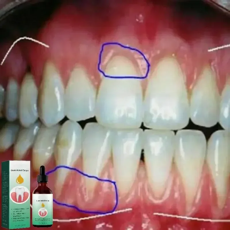 Quickly Repair Gum Serum Care Teeth Whiten Remove Yellow Repair Gum Regrowth Plaque Stains Relieve Gums Decay Toothache